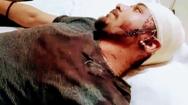 দৌলতখানে ক্রিকেট খেলা নিয়ে দ্বন্দ্বের জেরে হামলা, বসতঘর ভাঙচুর, আহত-৫