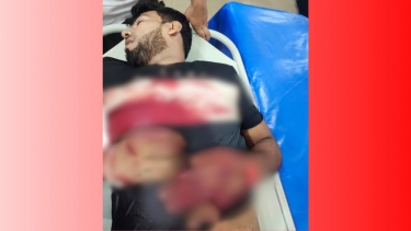 নোয়াখালীতে চাঁদা না পেয়ে প্রবাসীর হাতের কবজি কাটল সন্ত্রাসীরা