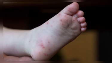 চীনে ছড়ালো ভাইরাসজনিত নতুন রোগ, জরুরি সতর্কতা জারি