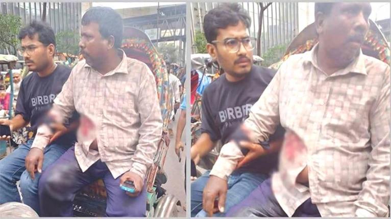 মতিঝিলে ব্যবসায়ীকে গুলি করে ১৭ হাজার ডলার ছিনতাই
