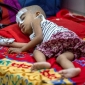 Five more children die of measles as death toll reaches 758 in Bangladesh
