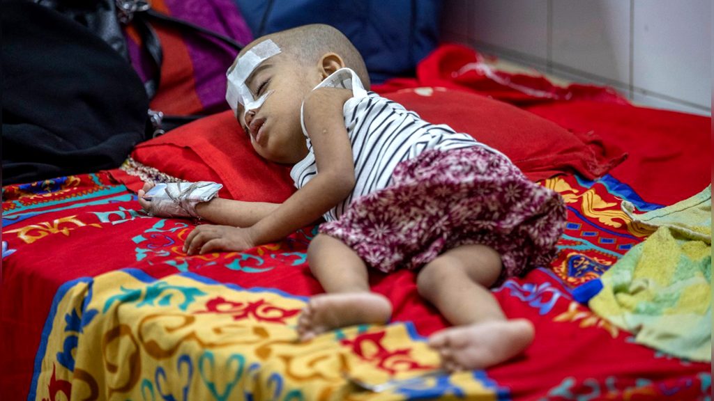 Five more children die of measles as death toll reaches 758 in Bangladesh